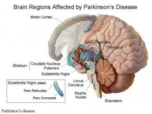 Parkinson's Disease KNOW MORE